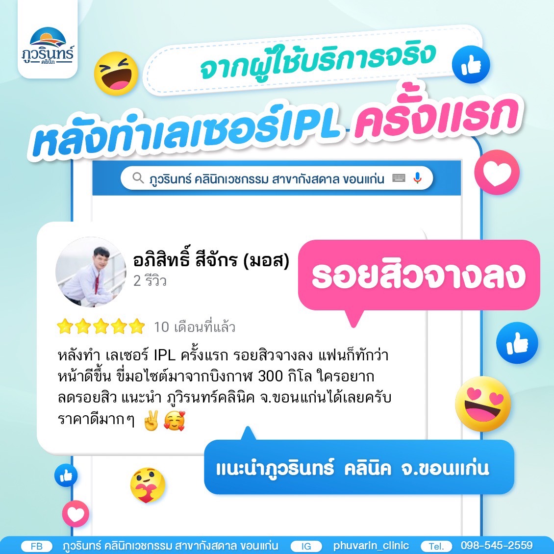 คัมภีร์เทคโนโลยีเลเซอร์ 5 เครื่องมาตรฐานสากล เจาะลึกการทำงานแต่ละเครื่อง
