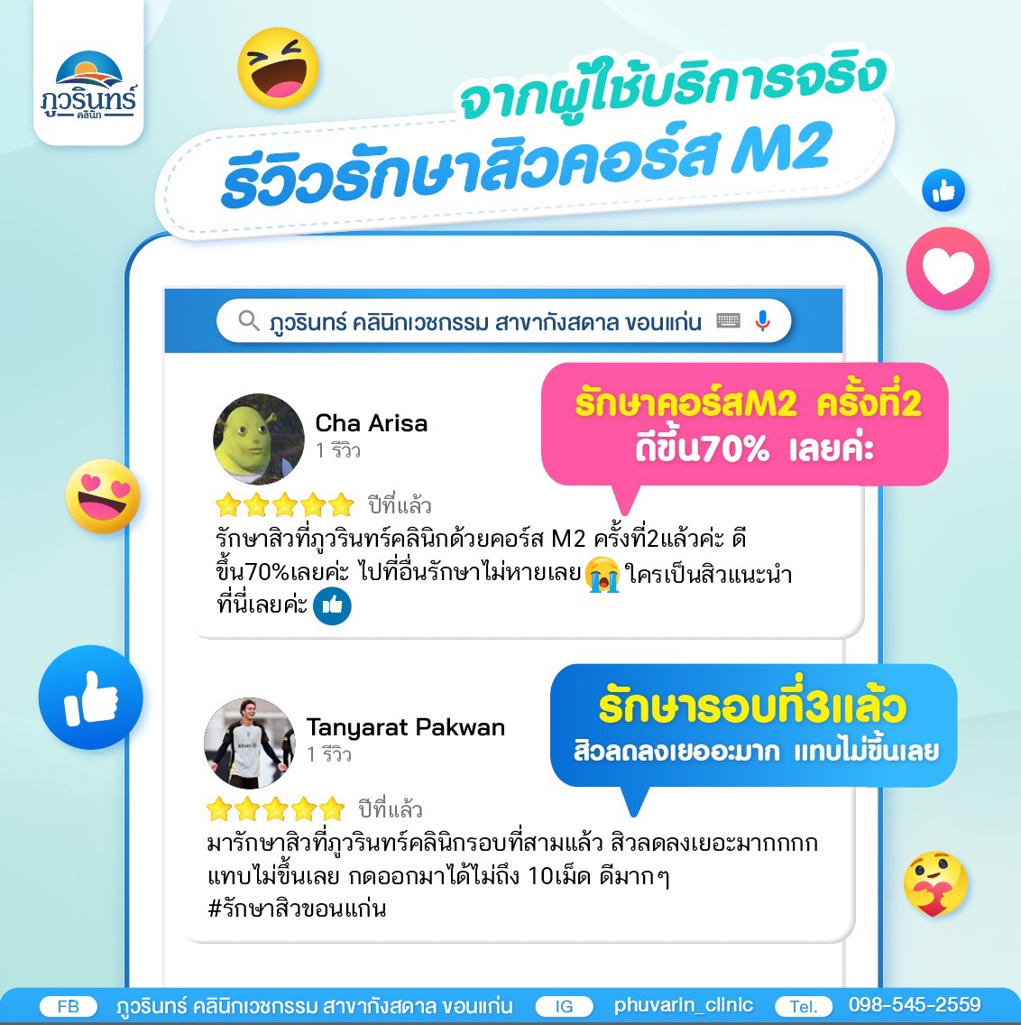 รีวิวรักษาสิวรอบที่สอง ภูวรินทร์คลินิก