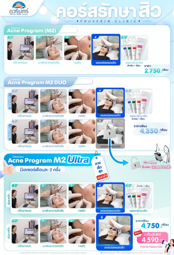 คอร์สรักษาสิว ภูวรินทร์คลินิก M2 M2 DUO M2 Ultra ขอนแก่น